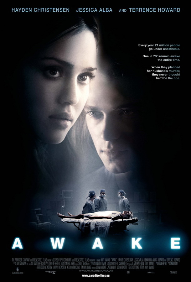 Наркоз / Awake